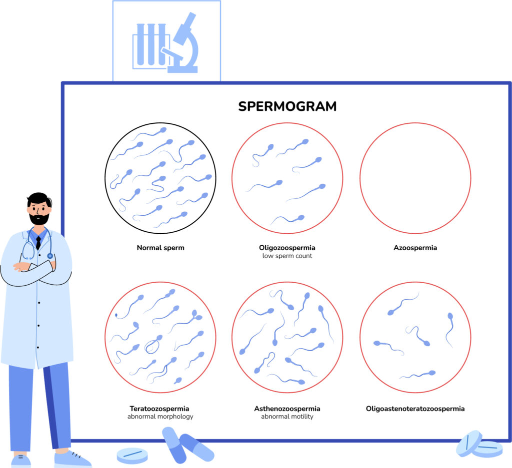 Spermogram